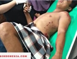 Tak Ada Plang Tanda, Proyek Perbaikan Jalan di Lapri Memakan Korban