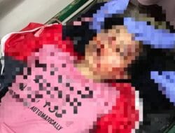 Parah, Mobil Pickup dengan Kecepatan Tinggi Seruduk Pengendara Motor di Lapri