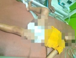 Tragis! Balita di Kajuara Bone Ditemukan Pingsan dengan Luka Memar di Sekujur Tubuh