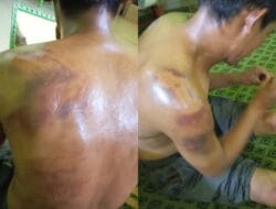 Seorang Pria di Bone Dianiaya Oknum Polisi