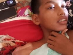 Aril, Penderita Tumor di Tanalanto Butuh Uluran Tangan