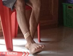 Pemburu Tak Sengaja Tembak Warga di Rattepadang, Korban Alami Luka di Betis