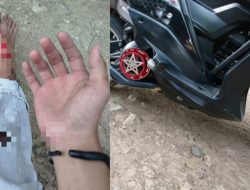 Mahasiswa di Majene Jadi Korban Tabrak Lari, Pelaku Kabur ke Arah Mamuju