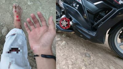 Mahasiswa di Majene Jadi Korban Tabrak Lari, Pelaku Kabur ke Arah Mamuju