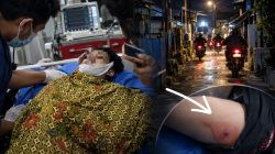 Foto: Rafli, korban penembakan di Bontoala, Makassar. (ENews)