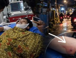 Pemuda Tewas Ditembak di Lorong Almarkaz Makassar, Polisi Selidiki Asal Proyektil
