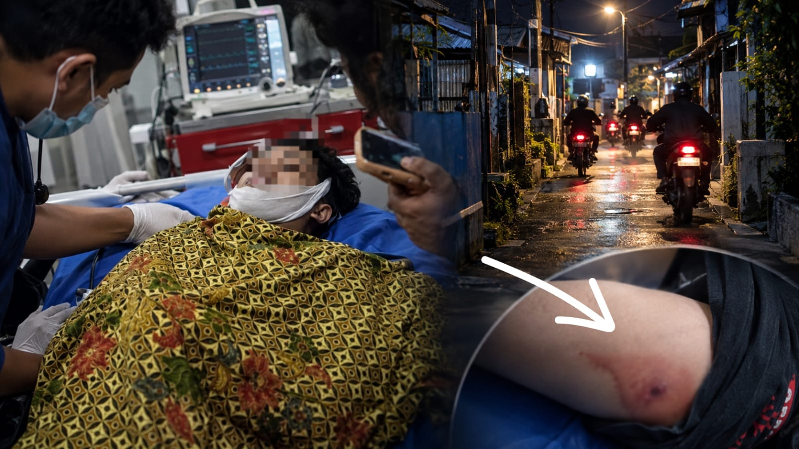 Foto: Rafli, korban penembakan di Bontoala, Makassar. (ENews)